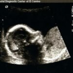 Paleo from Pregnancy